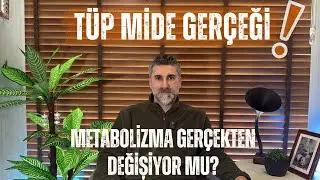 Tüp Mide Ameliyatı Gerçekten Metabolizmayı Yeniden Mi Başlatıyor ?