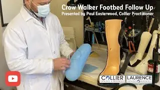 Quick follow up is key when treating a diabetic foot ulcer.