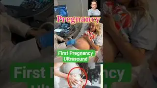 First Pregnancy Ultrasound #Baby Growth Scan#Baby Heartbeat in Pregnancy Ultrasound ❤️#bollywood