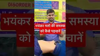 पेट में भयंकर नले की समस्या को कैसे पहचानें || #navel #bloating #gas #chiropractic #health #acidity