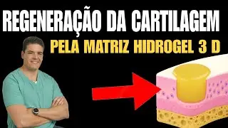 🔴 Regeneração da Cartilagem pela Matriz de Hidrogel!