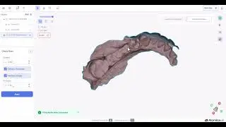 Auto fill for holes