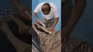 knee patella pain treatment for cupping therapy