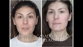 Como he acabado con las manchas del rostro