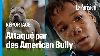 &laquo; J&rsquo;ai cru que j&rsquo;allais mourir &raquo; : Ha&iuml;l&eacute;, 10 ans, mordu au visage par des chiens American Bully