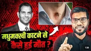 मधुमक्खी के काटने से कैसे हुई मौत 🐝#a2motivation #facts #a2sir #viralvideo #youtubreels #youtube