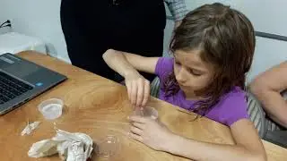 DNA Extraction from your cheek cells