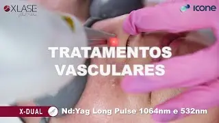 XLASE: avançado sistema de multiplataforma SQUARE PULSE com 5 diferentes tecnologias