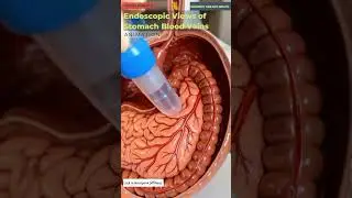 Endoscopic view of stomach blood veins#3danimation #digestivesystem #humanbody #digestiveprocess
