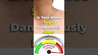 6 ALARMING Signs Your Blood Sugar Is HIGH |Diabetes Symptoms #shorts