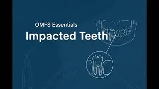 Episode 23 &mdash; Impacted Teeth : Sequelae of Impacted Mandibular Third Molars (Indications for Removal)