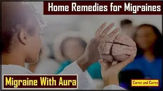 Quick Remedy For Migraine Headache | Migraine Treatment Home Remedies