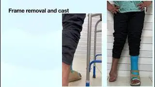 Centre for deformity correction and ilizarov surgery 