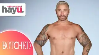 Superhero Body with Super-Fake Arms | Season 7 | Botched
