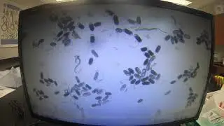 Root Knot Nematode Promo Clip