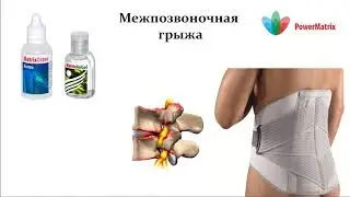 Межпозвоночная грыжа - Power Matrix