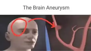 The Brain Aneurysm Music Video (The Mind Electric Instrumental Cover Demo)