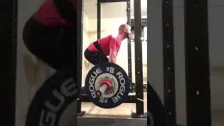 Deficit DL - 177.5x2