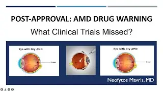 Post-Approval Insights: Adverse Events of AMD Treatments &ndash; Pegcetacoplan, Faricimab, & Brolucizumab