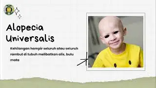 Alopecia Pada Anak