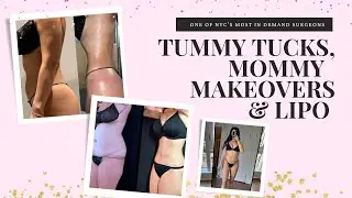 Transforming Bodies: Tummy Tucks, Liposuction, & Mommy Makeovers with Dr. Ryan Neinstein