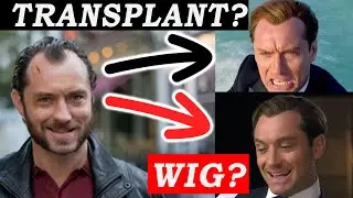 Jude Law Hair Transplant or Not!?