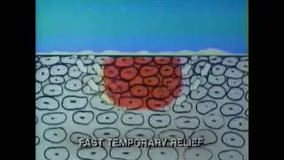 Cortizone Itch Cream Commercial (c.1990)