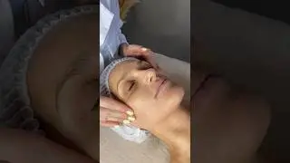 Антиоксидантная терапия для сухой и безжизненной кожи на профессиональной линии Pro You Coenzyme Q10