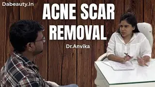  Acne Scar Removal Treatment || skin care Results || acne marks remove bye Dr Anvika 