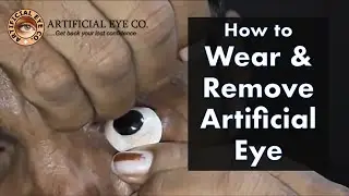 How to wear and remove Artificial Eye perfectly | Dr Sumitra