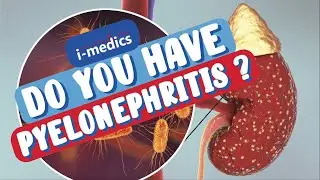 Do You Have a Kidney Infection? (60 second health check) 👨&zwj;⚕️🩺