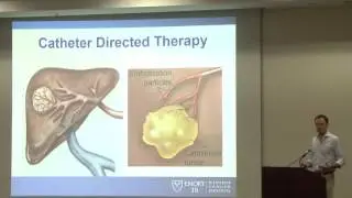 Dr.  Darren Kies- Localized Treatments for Metastatic Disease