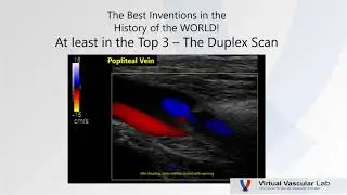 Duplex Scan Interpretation - Virtual Vascular Lab Channel