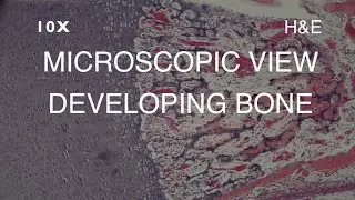 MICROSCOPIC VIEW - DEVELOPING BONE
