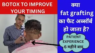 Penile Fat Grafting . Botox to improve timing ( Patient after 6 months)
