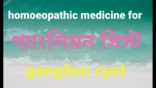 ganglion cyst | গ্যাংলিয়ন সিস্ট |   Bible cyst | treatment by homoeopathic medicine|
