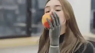 🌟 Meet the Future: Bionic Hand by Esper Bionics! 🤖💪