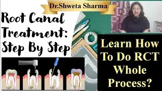 How To Do Root Canal Treatment Step By Step?🦷LIVE RCT Procedure in Hindi| Dr.Shweta Sharma