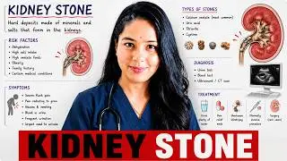 kidney stone II RENAL STONE causes symptoms treatment