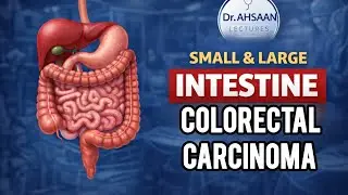 COLORECTAL CARCINOMA SURGICAL MANAGEMENT EXPLAINED |General Surgery For MBBS/USMLE.
