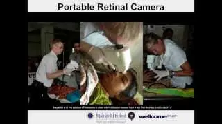 Reducing Deaths from Malaria - Dr Richard J Maude