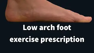Exercises for a low arch foot￼