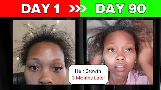 Do You Want Fast Hair Growth? Try This!  Black Girl Vitamins: Update Video