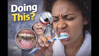 5 Dental Mistakes Wrecking Your Teeth (And How to Fix Them)
