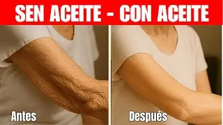 Dermatólogo Revela: El Secreto de 1 Minuto para Eliminar la Piel Arrugada del Brazo