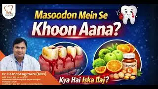 Bleeding Gums Causes & Treatment Explained,  Swez Dental Clinic, Jaipur