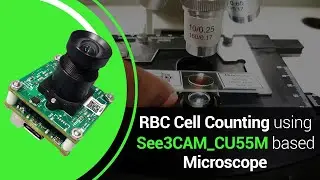 Monochrome camera for Digital Microscope | RBC cell counting using See3CAM_CU55M | e-con Systems