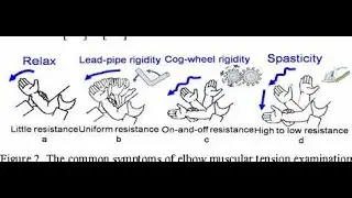 Difference between Cogwheel Rigidity and Lead Pipe Rigidity