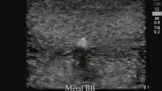 Leg Model with Foreign Body Targets