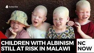 Children with Albinism Still Face Threats Despite Awareness Efforts in MalawiTY